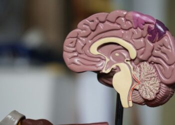 Yan profilden renkli beyin anatomisi modeli gösterilmektedir.